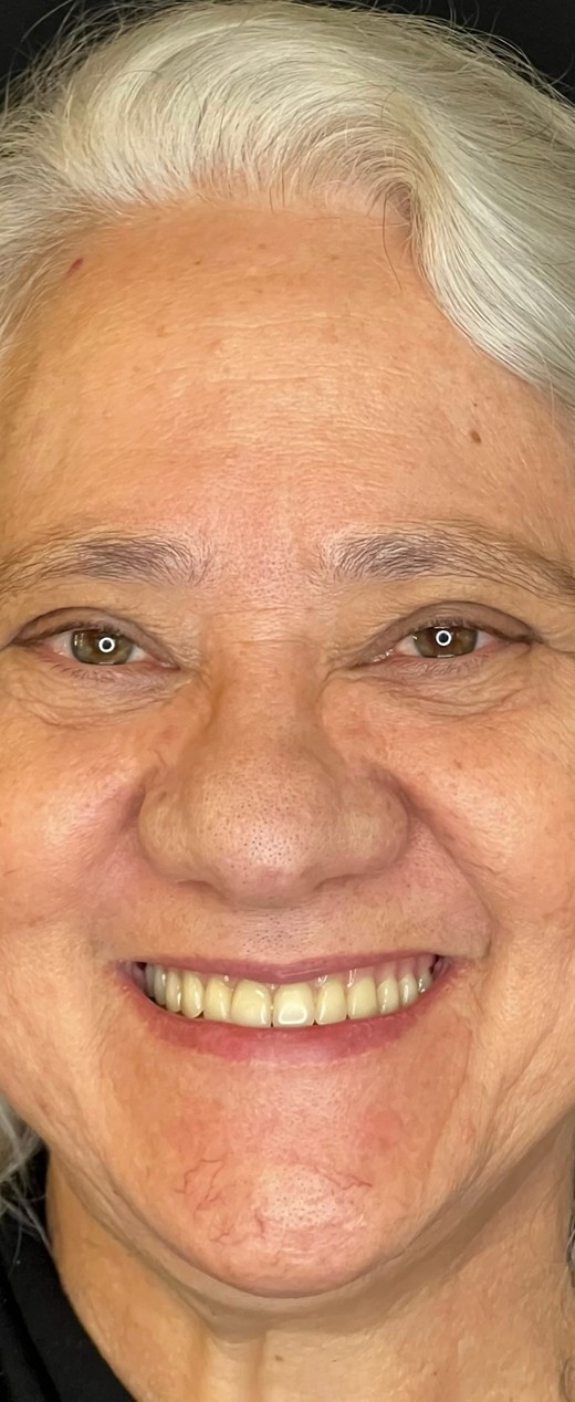 Paciente da clínica antes do tratamento, com os dentes escurecidos